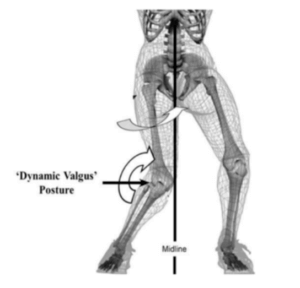 Mechanism of ACL injury